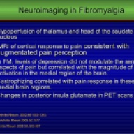 fibromyalgia-slide-cast066-22-638